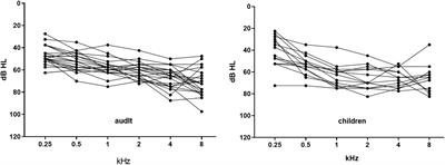 Effects of Wireless Remote <mark class="highlighted">Microphone</mark> on Speech Recognition in Noise for Hearing Aid Users in China